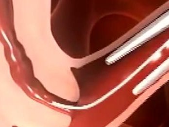 2026在扎兰屯市做基因检测多少钱？基因筛查可以规避哪些遗传病？