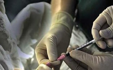 为什么自然周期移植容易失败